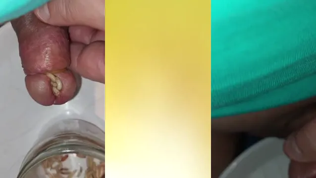 สุดขีด CBT การแทรก BDSM - บิดเบือน Maggot Feeding เครื่องรางความเจ็บปวด